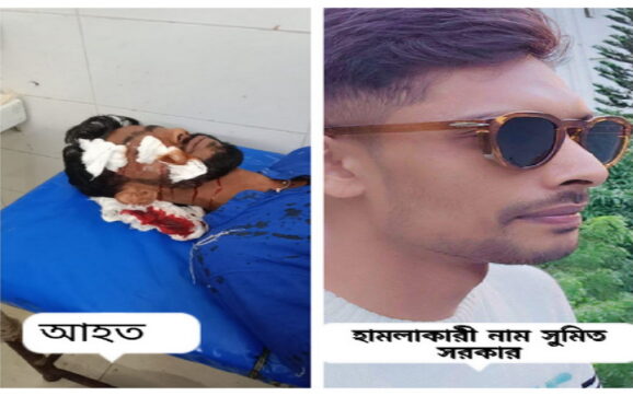 স্ত্রী পুলিশে চাকরি করায় ‘অতিরিক্ত ক্ষমতার দাপট’—গায়ে হলুদে হামলা করে গোপালকে রক্তাক্ত করল সুমিত সরকার