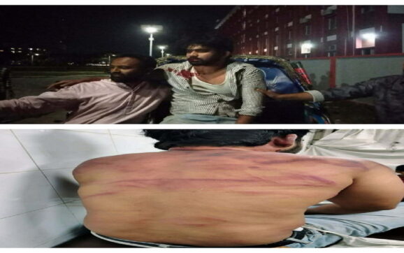 কিশোর গ্যাংয়ের হামলায় বরিশালে যুবক গুরুতর আহত