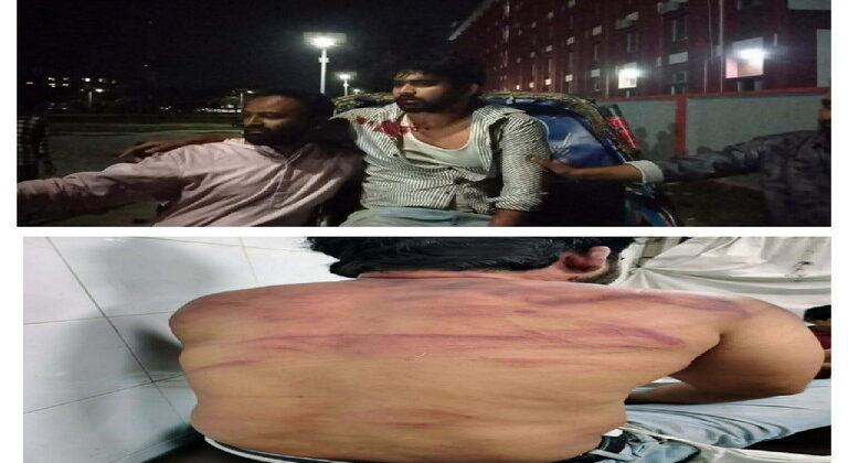 কিশোর গ্যাংয়ের হামলায় বরিশালে যুবক গুরুতর আহত