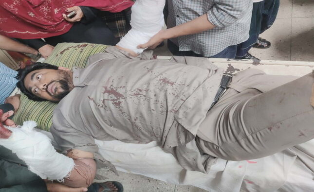 ব্যাটারি চুরিতে বাধা,রাজাপুর ছাত্রদল নেতাকে কুপিয়ে রক্তাক্ত—শেবাচিম থেকে ঢাকায় রেফার