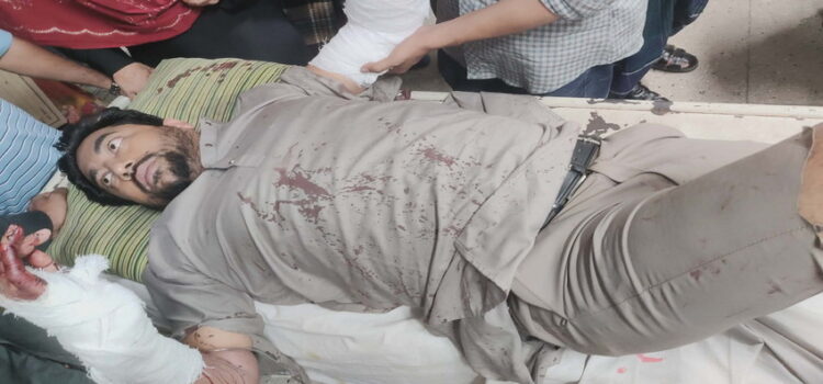 ব্যাটারি চুরিতে বাধা,রাজাপুর ছাত্রদল নেতাকে কুপিয়ে রক্তাক্ত—শেবাচিম থেকে ঢাকায় রেফার