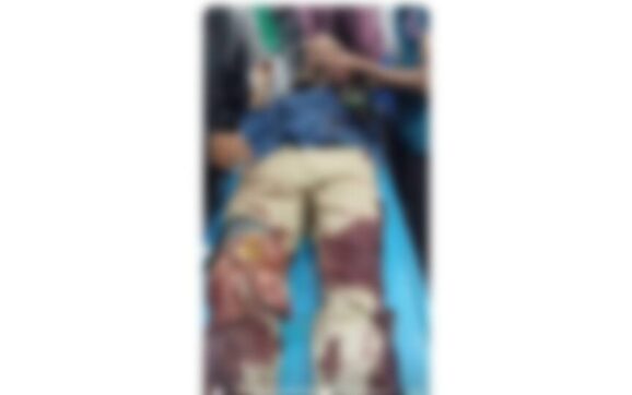 বরিশালে ছাত্রদল সভাপতিকে কুপিয়ে জখম, আশঙ্কাজনক অবস্থায় ঢাকায় প্রেরণ