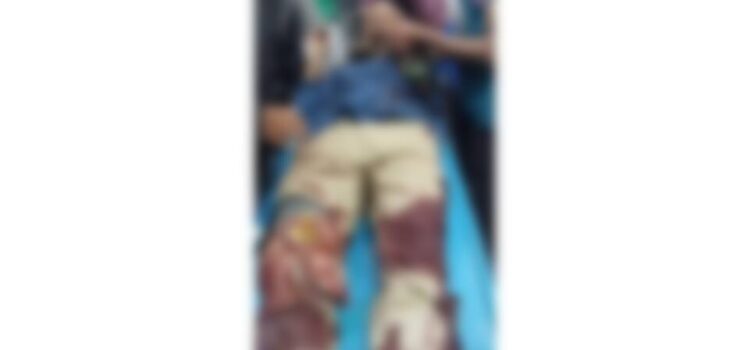 বরিশালে ছাত্রদল সভাপতিকে কুপিয়ে জখম, আশঙ্কাজনক অবস্থায় ঢাকায় প্রেরণ