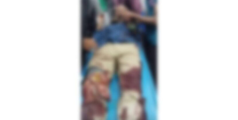 বরিশালে ছাত্রদল সভাপতিকে কুপিয়ে জখম, আশঙ্কাজনক অবস্থায় ঢাকায় প্রেরণ