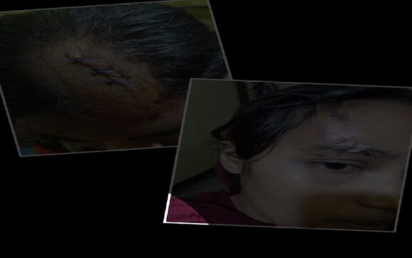 বাকেরগঞ্জে জমি সংক্রান্ত বিরোধের জেরে আহত-৬ আসামী গ্রেফতার করতে ব্যর্থ পুলিশ