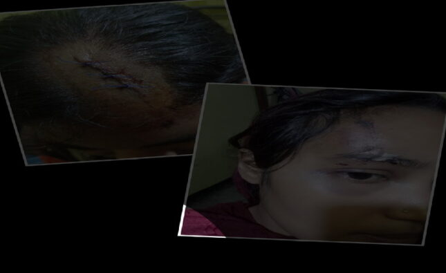 বাকেরগঞ্জে জমি সংক্রান্ত বিরোধের জেরে আহত-৬ আসামী গ্রেফতার করতে ব্যর্থ পুলিশ