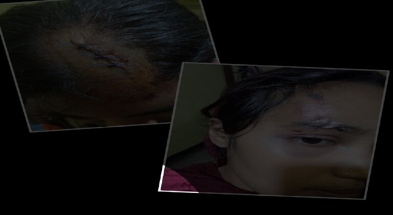 বাকেরগঞ্জে জমি সংক্রান্ত বিরোধের জেরে আহত-৬ আসামী গ্রেফতার করতে ব্যর্থ পুলিশ